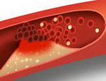 Cholesterol